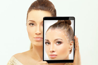 What Causes PCOS Hair Loss?
